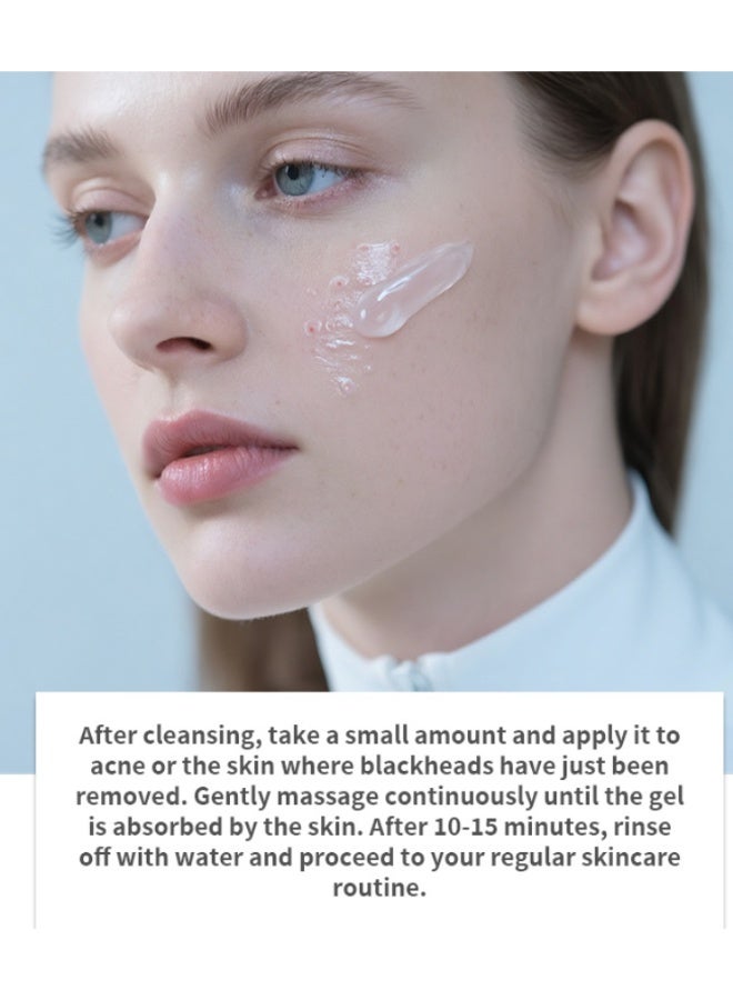 Radiant Acne Treatment Cream Anti Acne Gel Moisturizing For Oily And Acne Prone Skin - Image 2